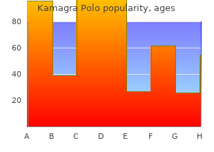 cheap 100mg kamagra polo free shipping