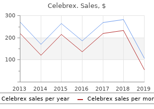 discount 100mg celebrex visa