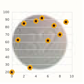 21 hydroxylase deficiency