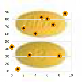 Brachyolmia recessive Hobaek type