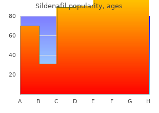 cheap sildenafil 75mg