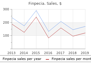 order finpecia 1 mg otc