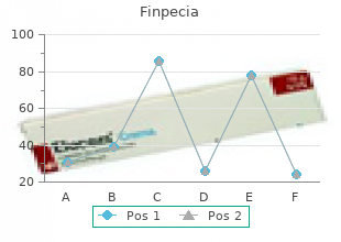 purchase finpecia 1mg line