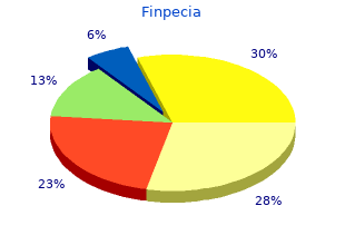 buy generic finpecia pills