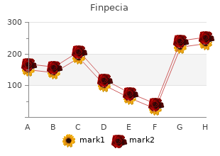 discount finpecia 1mg with mastercard