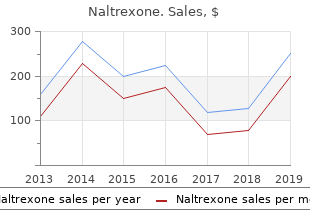 buy naltrexone pills in toronto