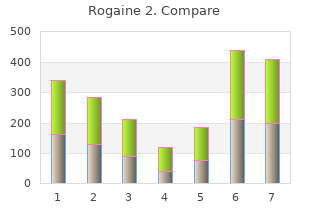 order rogaine 2 60  ml on-line