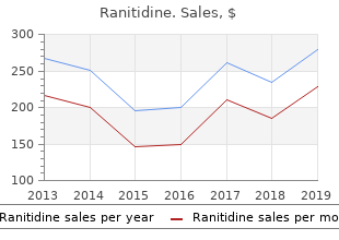 generic 150mg ranitidine overnight delivery