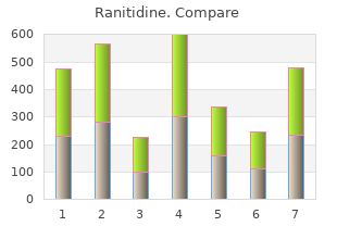 discount 300 mg ranitidine visa