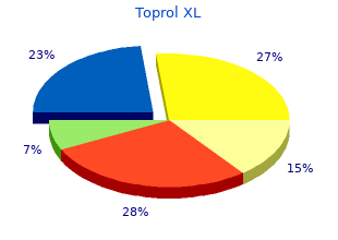 discount toprol xl 25mg on-line
