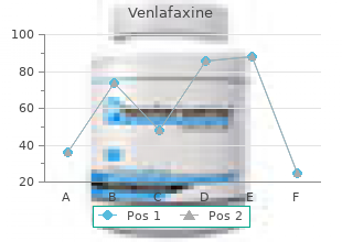 venlafaxine 150mg for sale