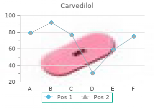 best buy carvedilol