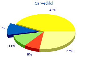 buy generic carvedilol 25mg on line