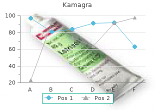 purchase kamagra with amex